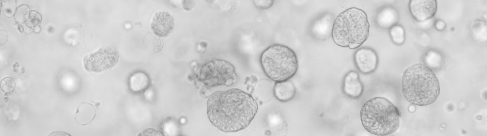 Lung cancer organoid