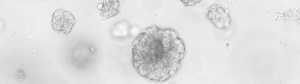 Gastric cancer organoid